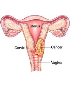 الصور endocervix