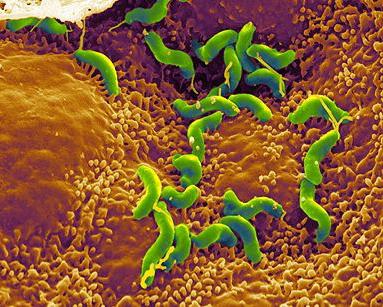 Helicobacter وعلاج الاستئصال