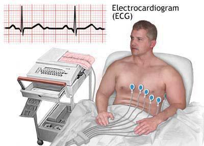 كيفية عمل تخطيط قلب كهربائي لطفل؟ كيف ECGs للنساء؟