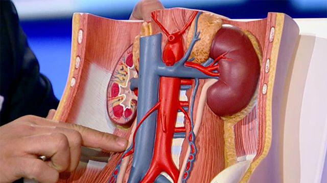 علاج الكلى بحجر الكلى