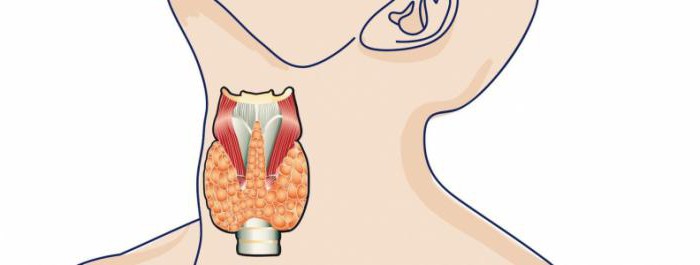 علاج التهاب الغدة الدرقية المناعة الذاتية: العلاجات الشعبية في المنزل