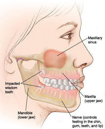 لدغة orthognathic